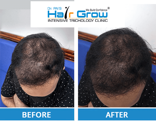 GFC hair Treatment before and after